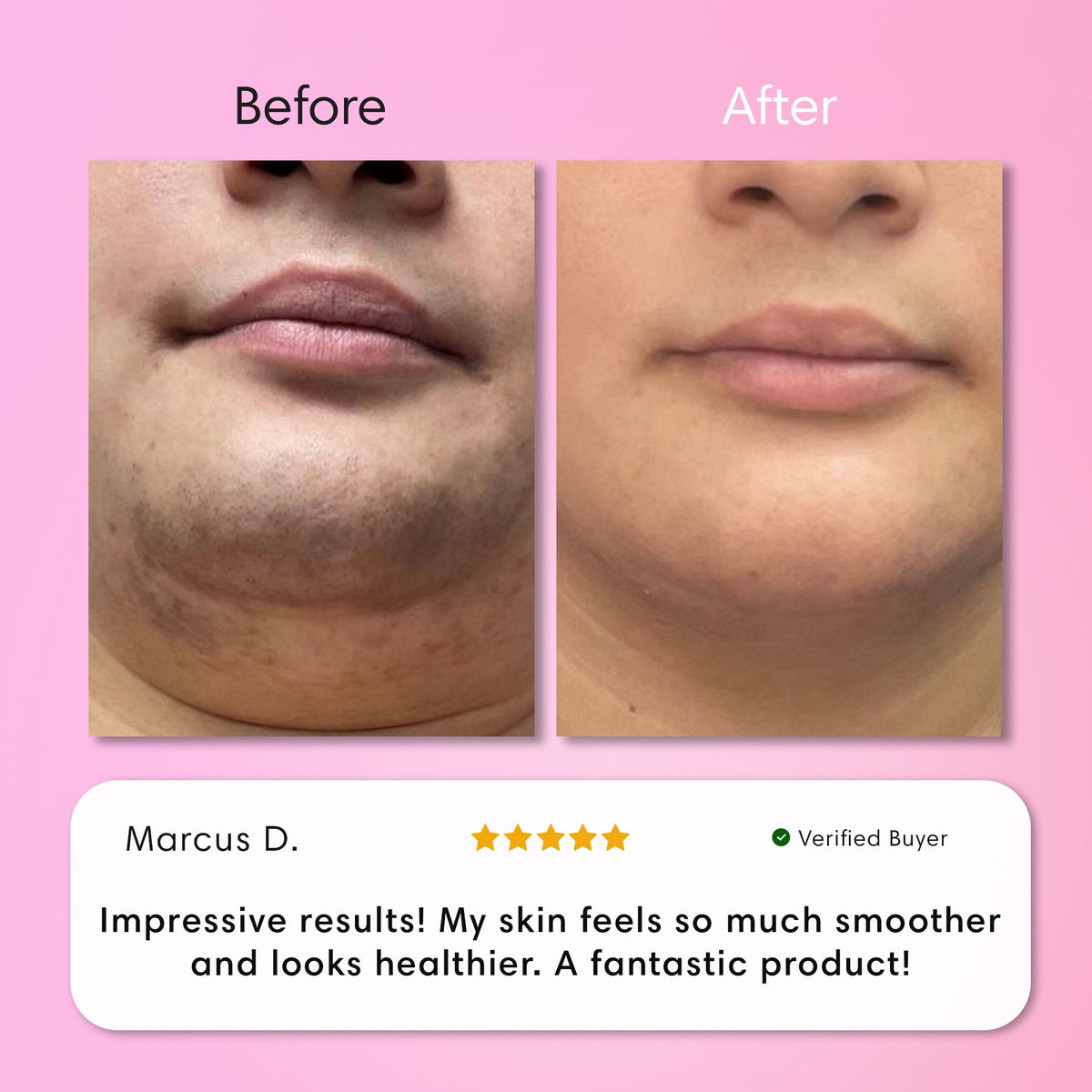Instant Hair Removal Kit