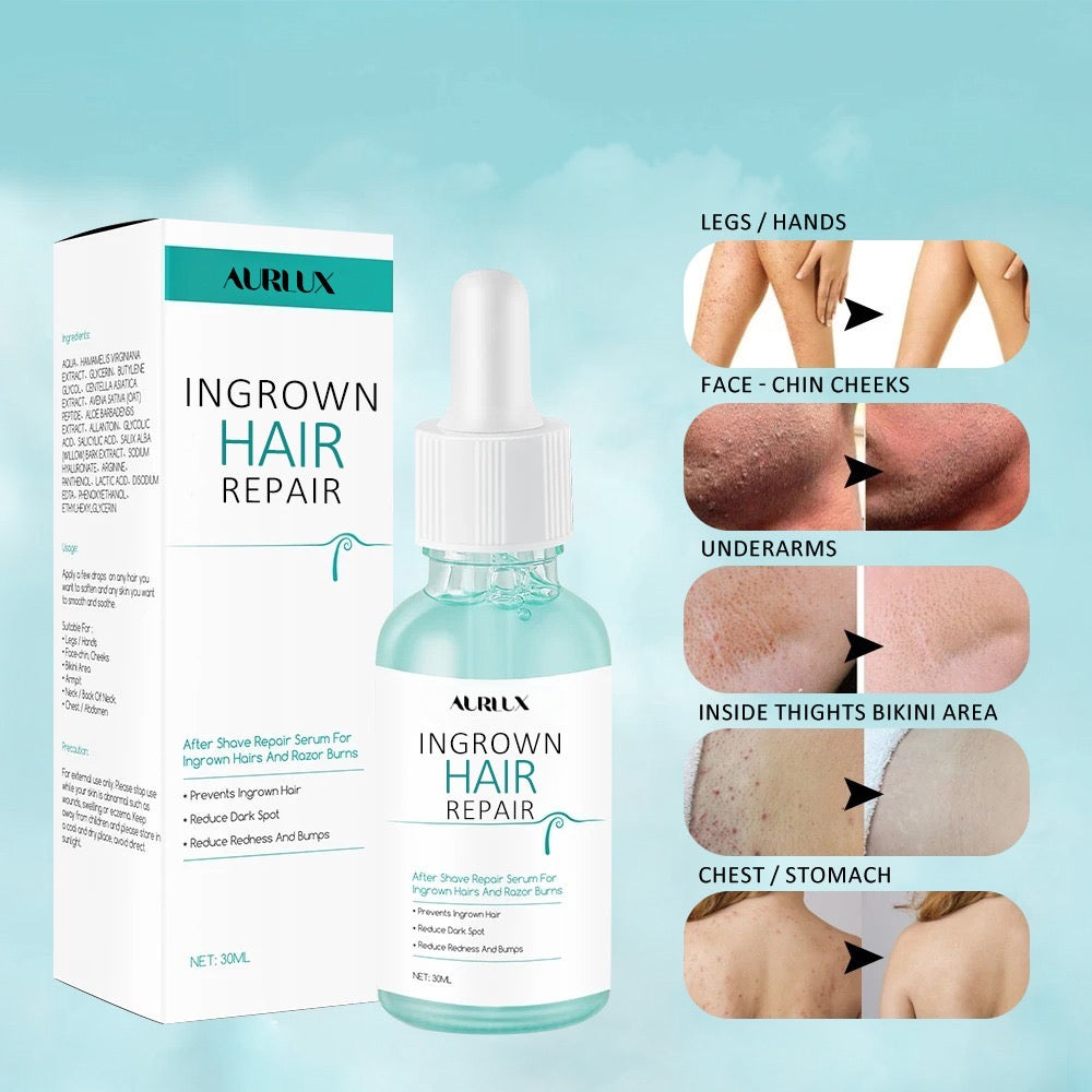 Ingrown Hair Repair Serum