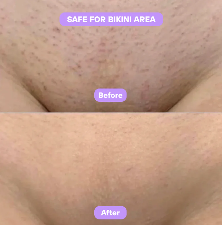 Cyperus Rotundus Skin Serum