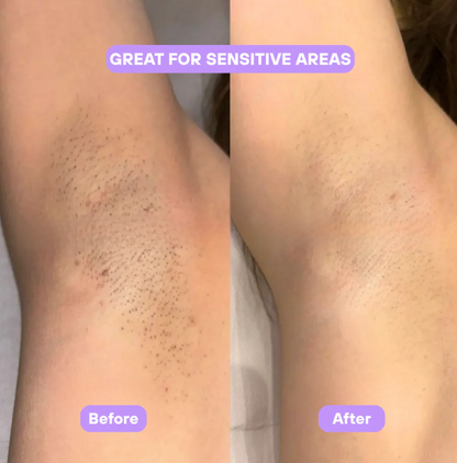Cyperus Rotundus Skin Serum