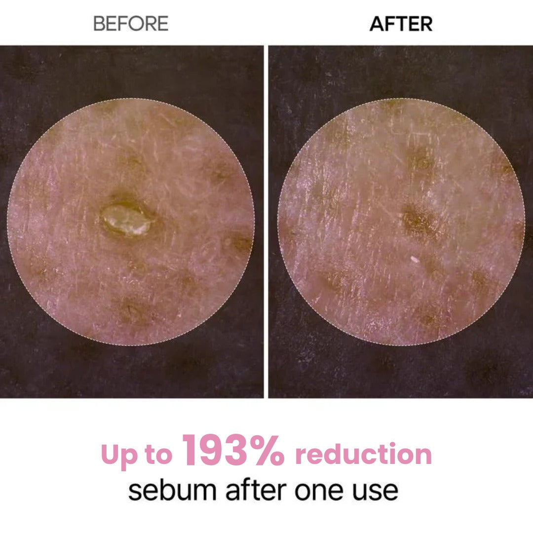 Peel Shot Glow Rice Ampoule Duo by Aurlux