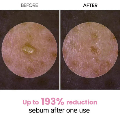 Peel Shot Glow Rice Ampoule Duo by Aurlux